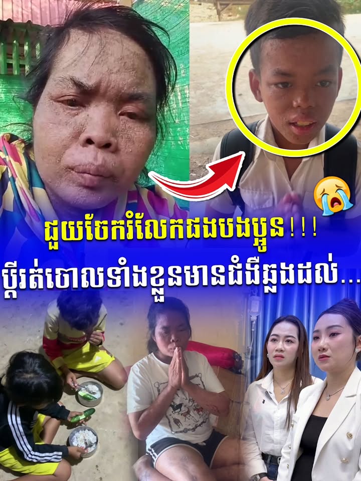 ទឹកភ្នែកអ្នកម្តាយ! ឈឺសើស្បែកជាង ២០ឆ្នាំ ប្តីរត់ចោល រែកពុនជីវិតរើសអេតចាយម្នាក់ឯង ឥឡូវកូនប្រុសមកឆ្លងជំងឺទៀត… សុំសប្បុរសជន និងម្ចាស់ក្រុមហ៊ុនចិត្តធម៌ជួយសង្គ្រោះផង! 😭🙏💔